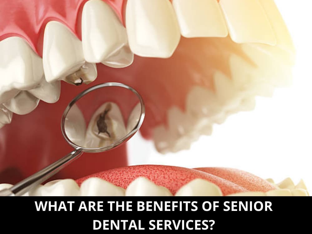 What Are the Benefits of Senior Dental Services_